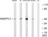 ANGPTL7 / CDT6 Antibody - Western blot analysis of lysates from Jurkat, COLO, HUVEC, and HepG2 cells, using ANGPTL7 Antibody. The lane on the right is blocked with the synthesized peptide.