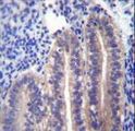 ANGPTL7 / CDT6 Antibody - ANGPTL7 Antibody immunohistochemistry of formalin-fixed and paraffin-embedded human uterus tissue followed by peroxidase-conjugated secondary antibody and DAB staining.