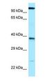 ANHX Antibody - ANHX antibody Western Blot of ACHN.  This image was taken for the unconjugated form of this product. Other forms have not been tested.
