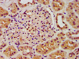 ANK3 / ANKYRIN-G Antibody - Immunohistochemistry image at a dilution of 1:300 and staining in paraffin-embedded human kidney tissue performed on a Leica BondTM system. After dewaxing and hydration, antigen retrieval was mediated by high pressure in a citrate buffer (pH 6.0) . Section was blocked with 10% normal goat serum 30min at RT. Then primary antibody (1% BSA) was incubated at 4 °C overnight. The primary is detected by a biotinylated secondary antibody and visualized using an HRP conjugated SP system.