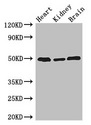 ANKRD10 Antibody - Western Blot Positive WB detected in: Mouse heart tissue, Mouse kidney tissue, Mouse brain tissue All lanes: ANKRD10 antibody at 4µg/ml Secondary Goat polyclonal to rabbit IgG at 1/50000 dilution Predicted band size: 45, 24 kDa Observed band size: 50 kDa