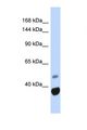 ANKRD12 Antibody - Western blot of Human Fetal Muscle. ANKRD12 antibody dilution 1.0 ug/ml.  This image was taken for the unconjugated form of this product. Other forms have not been tested.