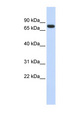 ANKRD13B Antibody - ANKRD13B antibody Western blot of Fetal Heart lysate. This image was taken for the unconjugated form of this product. Other forms have not been tested.