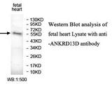 ANKRD13D Antibody