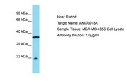 ANKRD18A Antibody -  This image was taken for the unconjugated form of this product. Other forms have not been tested.