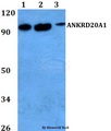 ANKRD20A1 Antibody - Western blot of ANKRD20A1 antibody at 1:500 dilution. Lane 1: HeLa whole cell lysate. Lane 2: sp2/0 whole cell lysate. Lane 3: PC12 whole cell lysate.