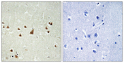 ANKRD26 Antibody - Immunohistochemistry analysis of paraffin-embedded human brain, using ANKRD26 Antibody. The picture on the right is blocked with the synthesized peptide.