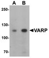 ANKRD27 Antibody - Western blot analysis of VARP in K562 cell lysate with VARP antibody at (A) 1 and (B) 2 ug/ml.