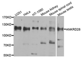 ANKRD28 Antibody - Western blot analysis of extracts of various cell lines.