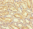 ANKRD33 Antibody - Immunohistochemistry of paraffin-embedded human kidney tissue using ANKRD33 Antibody at dilution of 1:100