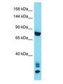 ANKRD36 Antibody - ANKRD36 antibody Western Blot of HepG2. Antibody dilution: 1 ug/ml.  This image was taken for the unconjugated form of this product. Other forms have not been tested.