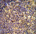 ANKRD44 Antibody - ANR44 Antibody immunohistochemistry of formalin-fixed and paraffin-embedded human tonsil tissue followed by peroxidase-conjugated secondary antibody and DAB staining.