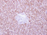 ANKRD45 Antibody - ANKRD45 antibody detects ANKRD45 protein at cytosol on Normal Liver by immunohistochemical analysis. Sample: Paraffin-embedded Normal Liver. ANKRD45 antibody dilution:1:500.