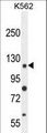 ANKRD52 Antibody - ANR52 Antibody western blot of K562 cell line lysates (35 ug/lane). The ANR52 antibody detected the ANR52 protein (arrow).