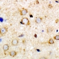 ANKRD52 Antibody - Immunohistochemical analysis of ANR52 staining in mouse brain formalin fixed paraffin embedded tissue section. The section was pre-treated using heat mediated antigen retrieval with sodium citrate buffer (pH 6.0). The section was then incubated with the antibody at room temperature and detected using an HRP conjugated compact polymer system. DAB was used as the chromogen. The section was then counterstained with hematoxylin and mounted with DPX.