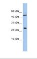 ANKRD7 Antibody - 721_B cell lysate. Antibody concentration: 1.0 ug/ml. Gel concentration: 10-20%.  This image was taken for the unconjugated form of this product. Other forms have not been tested.