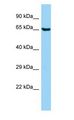 ANKS1B Antibody - EB-1 / ANKS1B antibody Western Blot of HepG2.  This image was taken for the unconjugated form of this product. Other forms have not been tested.