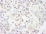 ANKS3 Antibody - Detection of Mouse ANKS3 by Immunohistochemistry. Sample: FFPE section of mouse teratoma. Antibody: Affinity purified rabbit anti-ANKS3 used at a dilution of 1:250.