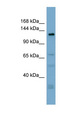 ANO3 / TMEM16C Antibody - ANO3 / Anoctamin-3 antibody Western blot of ACHN lysate. This image was taken for the unconjugated form of this product. Other forms have not been tested.