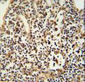 ANO5 / Anoctamin 5 Antibody - ANO5 Antibody immunohistochemistry of formalin-fixed and paraffin-embedded human lymph tissue followed by peroxidase-conjugated secondary antibody and DAB staining.