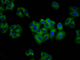 ANO6 Antibody - Immunofluorescence staining of HepG2 cells diluted at 1:100, counter-stained with DAPI. The cells were fixed in 4% formaldehyde, permeabilized using 0.2% Triton X-100 and blocked in 10% normal Goat Serum. The cells were then incubated with the antibody overnight at 4°C.The Secondary antibody was Alexa Fluor 488-congugated AffiniPure Goat Anti-Rabbit IgG (H+L).