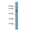 ANO9 / TMEM16J Antibody - Western blot of Human PANC1. ANO9 antibody dilution 1.0 ug/ml.  This image was taken for the unconjugated form of this product. Other forms have not been tested.