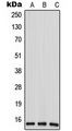 ANP32D Antibody - Western blot analysis of ANP32D expression in HeLa (A); mouse liver (B); rat liver (C) whole cell lysates.