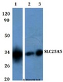 ANT2 / SLC25A5 Antibody - Western blot of SLC25A5 antibody at 1:500 dilution. Lane 1: HEK293Twhole cell lysate.