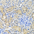 ANTXR2 / CMG2 Antibody - Immunohistochemistry of paraffin-embedded mouse kidney using ANTXR2 antibody at dilution of 1:100 (x40 lens).