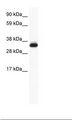 ANXA5 / Annexin V Antibody - Placenta Lysate.  This image was taken for the unconjugated form of this product. Other forms have not been tested.