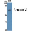 ANXA6/Annexin A6/Annexin VI Antibody - Western blot of Annexin VI antibody