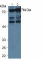 ANXA6/Annexin A6/Annexin VI Antibody - Western Blot; Sample: Lane1: Human Serum; Lane2: Human Hela Cells.