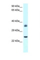 AP-1 / JUND Antibody - JUND antibody Western blot of Rat Brain lysate. Antibody concentration 1 ug/ml.  This image was taken for the unconjugated form of this product. Other forms have not been tested.