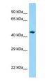 AP1M1 Antibody - AP1M1 antibody Western Blot of Human Lung.  This image was taken for the unconjugated form of this product. Other forms have not been tested.