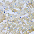 AP1M2 Antibody - Immunohistochemistry of paraffin-embedded human liver injury tissue.