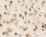 AP3M1 Antibody - Immunohistochemistry of AP3M1 in mouse brain tissue with AP3M1 antibody at 5 ug/ml.