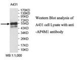 AP4M1 Antibody - Western blot of AP4M1 antibody