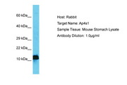 AP4S1 Antibody -  This image was taken for the unconjugated form of this product. Other forms have not been tested.