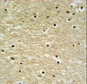 AP5Z1 Antibody - K0415 Antibody IHC of formalin-fixed and paraffin-embedded human brain tissue followed by peroxidase-conjugated secondary antibody and DAB staining.