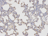 APBB1 / FE65 Antibody - Immunohistochemistry of paraffin-embedded rat testis using APBB1 antibody at dilution of 1:100 (200x lens).