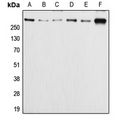 APC Antibody - Western blot analysis of APC (pS2054) expression in HeLa (A); Caco2 (B); SW480 (C); MCF7 (D); SP2/0 (E); PC12 (F) whole cell lysates.