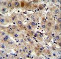 Apg7 / ATG7 Antibody - APG7L Antibody(D555) immunohistochemistry of formalin-fixed and paraffin-embedded human liver tissue followed by peroxidase-conjugated secondary antibody and DAB staining.