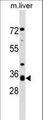 APH1A / APH-1 Antibody - APH1A Antibody western blot of mouse liver tissue lysates (35 ug/lane). The APH1A antibody detected the APH1A protein (arrow).