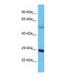 APH1B Antibody - Western blot of Human Lung Tumor. APH1B antibody dilution 1.0 ug/ml.  This image was taken for the unconjugated form of this product. Other forms have not been tested.