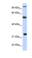 APOBEC1 Antibody - APOBEC1 antibody Western blot of Fetal Liver lysate. This image was taken for the unconjugated form of this product. Other forms have not been tested.