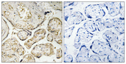 APOBEC3D + APOBEC3F Antibody - Immunohistochemistry analysis of paraffin-embedded human placenta tissue, using APOBEC3D/F Antibody. The picture on the right is blocked with the synthesized peptide.