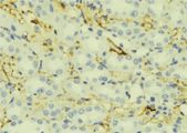 APOC2 / Apolipoprotein C II Antibody - 1:100 staining mouse liver tissue by IHC-P. The sample was formaldehyde fixed and a heat mediated antigen retrieval step in citrate buffer was performed. The sample was then blocked and incubated with the antibody for 1.5 hours at 22°C. An HRP conjugated goat anti-rabbit antibody was used as the secondary.