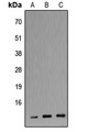 APOC3 / Apolipoprotein C III Antibody - Western blot analysis of Apolipoprotein C3 expression in HEK293T (A); Raw264.7 (B); H9C2 (C) whole cell lysates.