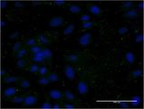 APOC3 / Apolipoprotein C III Antibody - Immunofluorescence of monoclonal antibody to APOC3 on HeLa cell . [antibody concentration 10 ug/ml]
