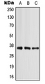 APOE / Apolipoprotein E Antibody - Western blot analysis of Apolipoprotein E expression in MCF7 (A); mouse liver (B); rat liver (C) whole cell lysates.